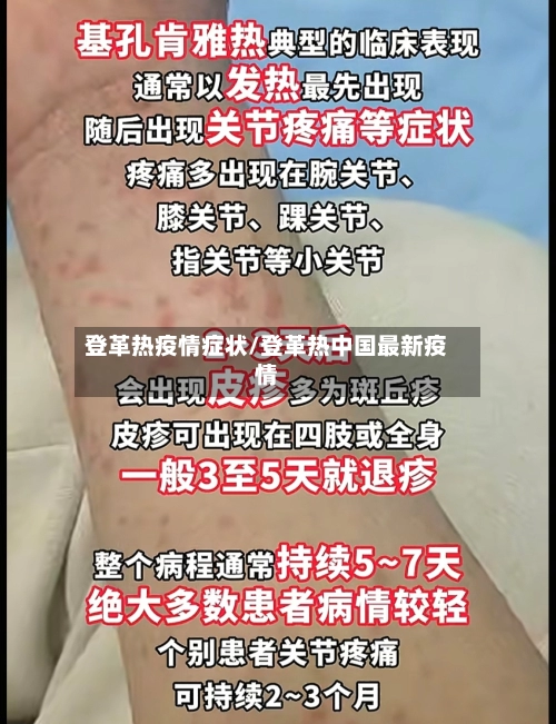 登革热疫情症状/登革热中国最新疫情-第1张图片