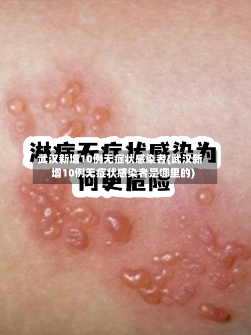 武汉新增10例无症状感染者(武汉新增10例无症状感染者是哪里的)-第3张图片